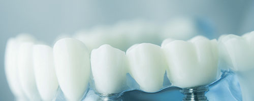 teeths-and-screw-close-up